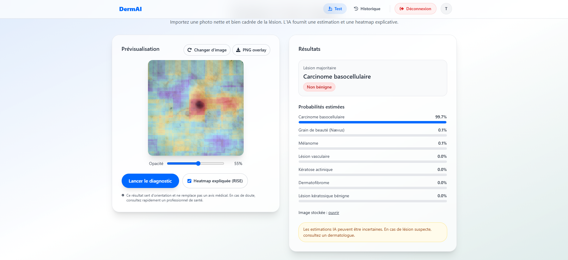 Interface des résultats avec heatmap